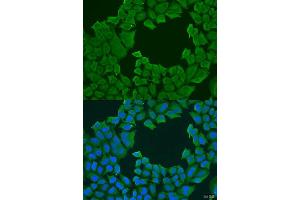 Immunofluorescence analysis of U2OS cells using STXBP3 antibody. (STXBP3 抗体  (AA 343-592))
