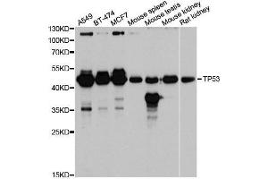 Western blot analysis of extracts of various cell lines, using TP53 antibody. (p53 抗体  (AA 1-100))