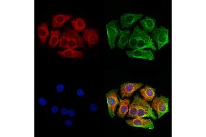 ABIN6261019 and ABIN6273216 staining Hela cells by IF/ICC. (CRAT 抗体  (N-Term))