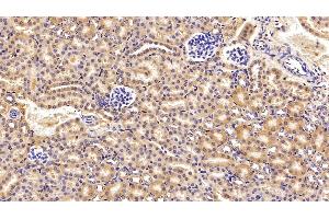 Detection of C3 Convertase in Mouse Kidney Tissue using Polyclonal Antibody to Complement C3 Convertase (C3 Convertase) (Complement C3 Convertase 抗体)