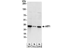 anti-Activator of Basal Transcription 1 (Abt1) (AA 1-50) antibody