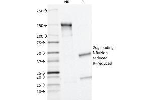 SDS-PAGE Analysis Purified MRP1/ABCC1 Monoclonal Antibody (MRP1/1343). (ABCC1 抗体)