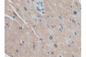 DAB staining on IHC-P; Samples: Rat Heart Tissue (RSPO1 抗体  (AA 21-135))