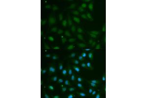 Immunofluorescence analysis of MCF7 cell using ABO antibody. (ABO 抗体  (AA 54-354))