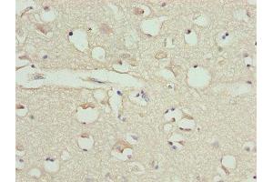 Immunohistochemistry of paraffin-embedded human brain tissue using ABIN7146563 at dilution of 1:100 (Calreticulin 抗体  (AA 18-415))