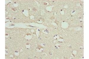 Immunohistochemistry of paraffin-embedded human brain tissue using ABIN7146563 at dilution of 1:100 (Calreticulin 抗体  (AA 18-415))