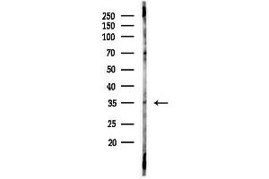 Western blot analysis of lysates from Hela cells(heat-shock,45 min treatment), using OR13 Antibody at 1/1000 dilution.