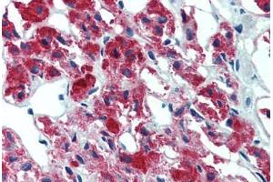Adrenal, Human: Formalin-Fixed, Paraffin-Embedded (FFPE) (IL23A 抗体)