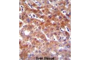 Immunohistochemistry (IHC) image for anti-Cytochrome P450, Family 1, Subfamily A, Polypeptide 2 (CYP1A2) antibody (ABIN2996139) (CYP1A2 抗体)