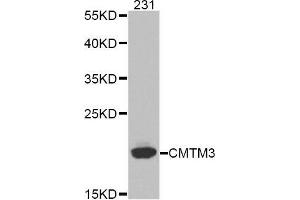 Western blot analysis of extracts of 231 cell line, using CMTM3 antibody. (CMTM3 抗体)