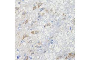 Immunohistochemistry of paraffin-embedded rat brain using CHIC2 antibody at dilution of 1:100 (x40 lens). (CHIC2 抗体)