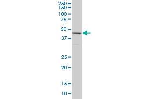 HNRNPG-T monoclonal antibody (M01), clone 6F11 Western Blot analysis of HNRNPG-T expression in HeLa . (RBMXL2 抗体  (AA 1-90))