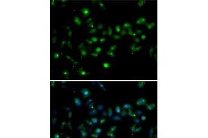 Immunofluorescence analysis of MCF7 cells using MORF4L1 Polyclonal Antibody (MORF4L1 抗体)