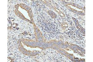 IHC analysis of GRPEL1 using anti-GRPEL1 antibody (ABIN7602643). (GRPEL1 抗体  (AA 90-217))