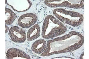 Image no. 3 for anti-Prefoldin Subunit 3 (PFDN3) antibody (ABIN1501702)