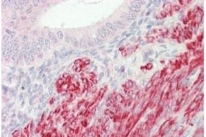 Human Uterus: Formalin-Fixed, Paraffin-Embedded (FFPE)