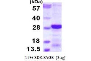 SDS-PAGE (SDS) image for Regulator of Calcineurin 2 (RCAN2) (AA 1-197) protein (His tag) (ABIN667616) (RCAN2 Protein (AA 1-197) (His tag))