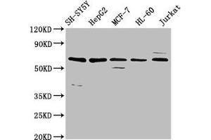 Western Blot Positive WB detected in: SH-SY5Y whole cell lysate, HepG2 whole cell lysate, MCF-7 whole cell lysate, HL-60 whole cell lysate, Jurkat whole cell lysate All lanes: HRG antibody at 4. (HRG 抗体  (AA 412-511))