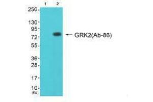 Western blot analysis of extracts from cos-7 cells (Lane 2), using GRK2 (Ab-86) antiobdy.
