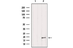 Western blot analysis of extracts from B16F10, using MAX Antibody. (MAX 抗体  (N-Term))