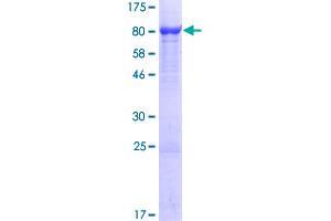 WDR1 Protein (AA 1-606) (GST tag)