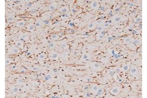 ABIN6272737 at 1/200 staining Rat brain tissue sections by IHC-P. (P2RY12 抗体  (N-Term))