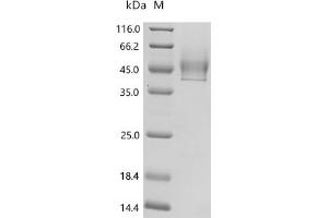 (Tris-Glycine gel) Discontinuous SDS-PAGE (reduced) with 5 % enrichment gel and 15 % separation gel.