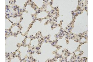 Immunohistochemistry (IHC) image for anti-thromboxane A Synthase 1 (Platelet) (TBXAS1) antibody (ABIN1875427) (TBXAS1 抗体)