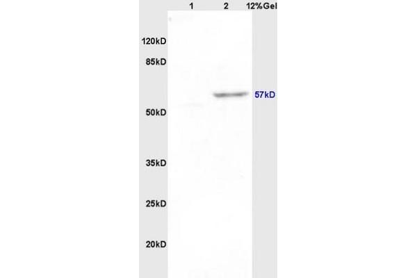 Pancreatic Amylase 抗体  (AA 151-250)