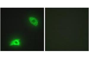 Immunofluorescence analysis of HeLa cells, using DUSP6 Antibody. (DUSP6 抗体  (AA 61-110))