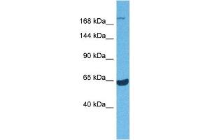 Western Blotting (WB) image for anti-ATP-Binding Cassette, Sub-Family A (ABC1), Member 7 (ABCA7) (Middle Region) antibody (ABIN2781526)