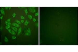 Immunofluorescence analysis of A549 cells, using Stefin A Antibody . (CSTA 抗体  (Internal Region))