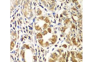 Immunohistochemistry of paraffin-embedded Human gastric using RAC1 Polyclonal Antibody at dilution of 1:100 (40x lens). (RAC1 抗体)
