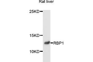 Western blot analysis of extracts of rat liver, using RBP1 antibody (ABIN6003736) at 1/1000 dilution. (RBP1 抗体)