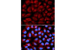 Immunofluorescence analysis of U2OS cell using FANCC antibody. (FANCC 抗体)