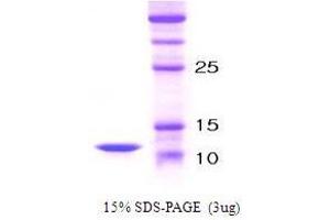 Figure annotation denotes ug of protein loaded and % gel used. (PTH 蛋白)
