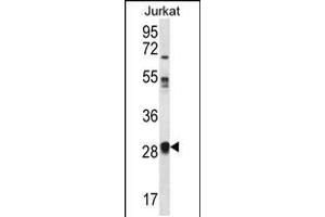 Western blot analysis in Jurkat cell line lysates (35ug/lane). (OR11L1 抗体  (C-Term))