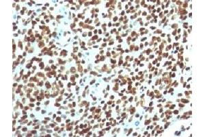 IHC testing of FFPE human tonsil with Nuclear Antigen antibody. (Nuclear Antigen 抗体)