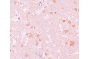 Immunohistochemical staining of human brain cells with NLRP7 polyclonal antibody  at 10 ug/mL.