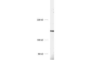 dilution: 1 : 1000, sample: rat hippocampus homogenate (UBE3B 抗体)