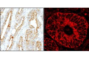anti-MAP-Kinase Activating Death Domain (MADD) (AA 1597-1647) antibody