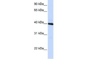 WB Suggested Anti-CEBPB Antibody Titration: 0. (CEBPB 抗体  (N-Term))