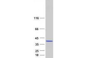Western Blotting (WB) image for Charged Multivesicular Body Protein 3 (CHMP3) (Transcript Variant 1) protein (Myc-DYKDDDDK Tag) (ABIN2735415)