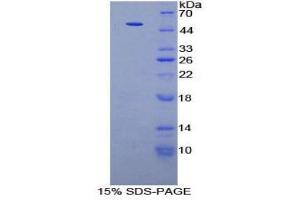 SDS-PAGE (SDS) image for Pyruvate Kinase M2 (PKM2) (AA 294-470) protein (His tag,GST tag) (ABIN2123547)