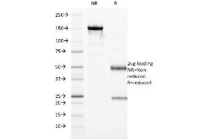SDS-PAGE Analysis Purified Granzyme B Mouse Monoclonal Antibody (GZMB/3014).