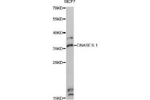Western blot analysis of extracts of MCF7 cells, using DNASE1L1 Antibody (ABIN6292460) at 1:3000 dilution. (DNASEX 抗体)