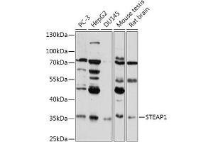 Western blot analysis of extracts of various cell lines, using STE antibody (ABIN7270331) at 1:1000 dilution. (STEAP1 抗体  (AA 1-80))