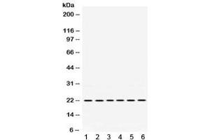 Western blot testing of 1) rat spleen, 2) rat stomach, 3) rat intestine, 4) human MCF7, 5) human A549 and 6) human SKOV lysate with BIK antibody.
