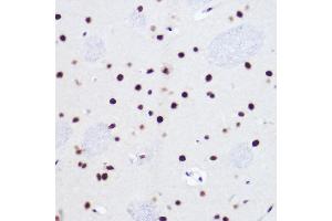Immunohistochemistry (IHC) image for anti-Ubiquitin Specific Peptidase 39 (USP39) antibody (ABIN7271160)