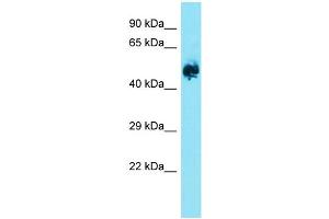 Host: Rabbit  Target Name: Eif2b3  Sample Tissue: Rat Brain lysates  Antibody Dilution: 1. (EIF2B3 抗体  (Middle Region))